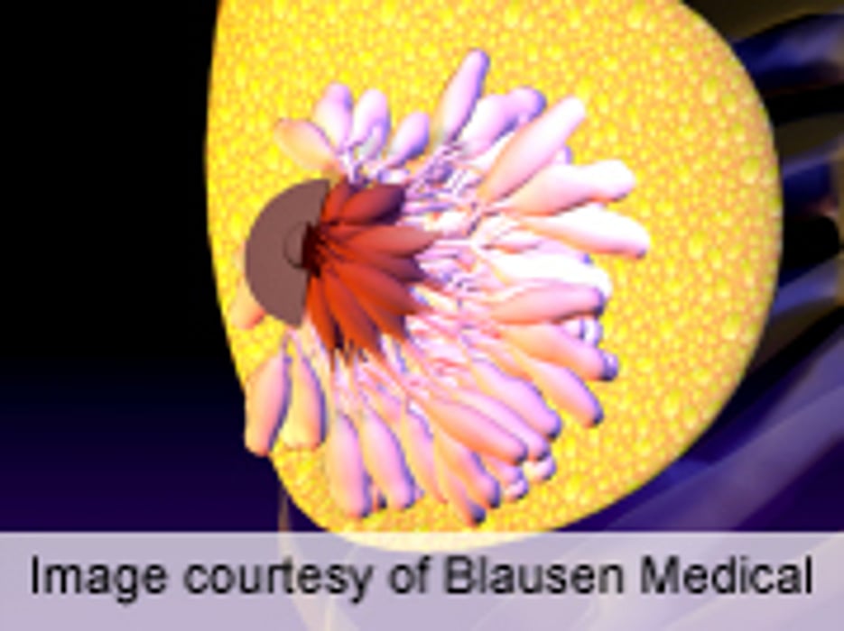 ASCO: BMI, Menopause Status Linked to Breast Inflammation