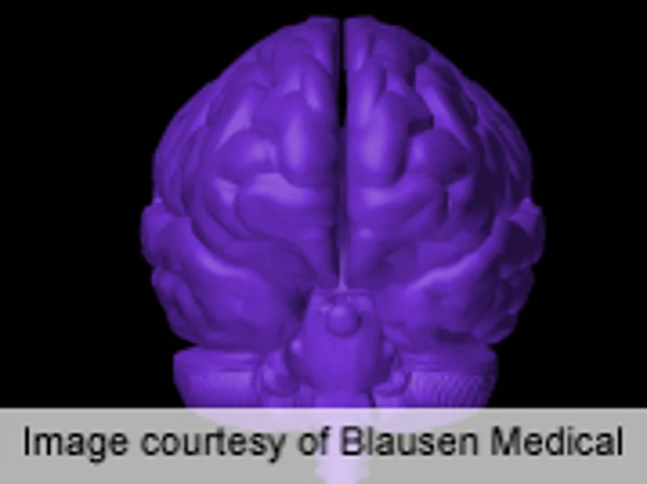 Abnormal Brain Activity Seen in Hoarding Disorder