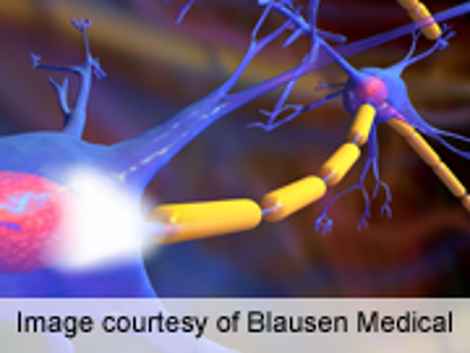 Device Reduces Epileptic Seizure Duration in Rats