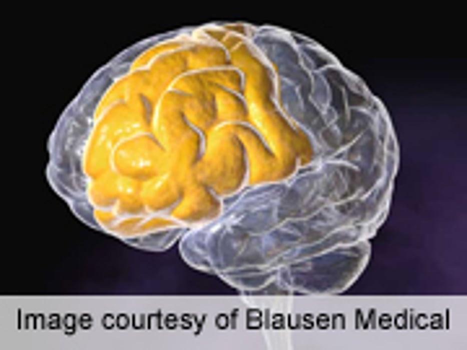 Benefits of Bilingualism Apply With Minority Language