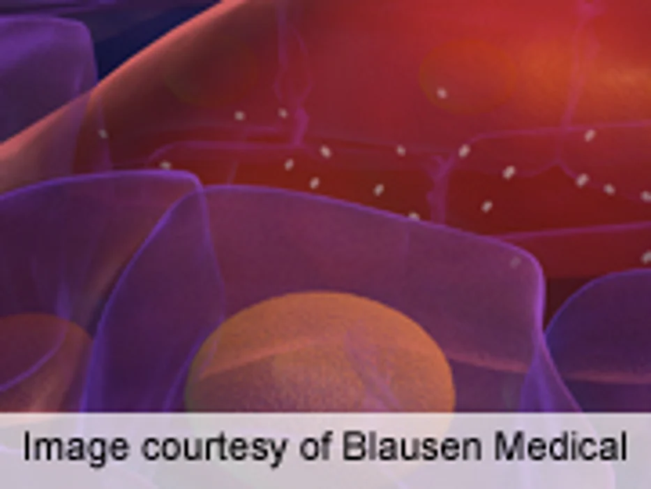 Exenatide Has Hemodynamic Effects in Healthy Men