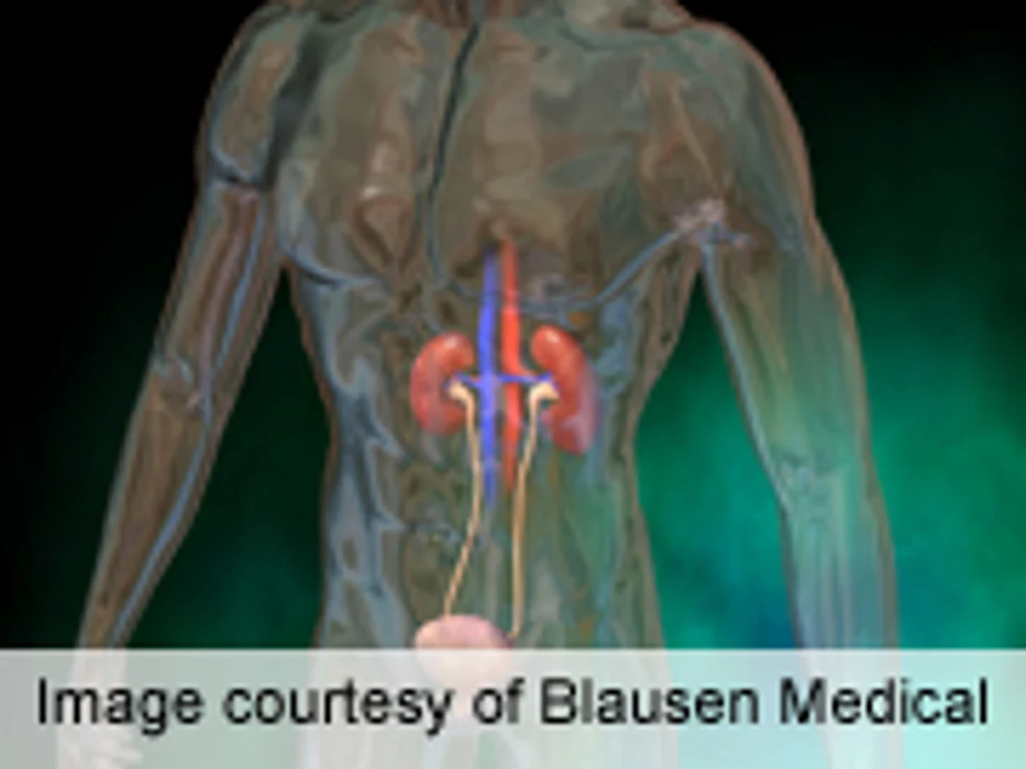 Urinary Proteomics Aids Early ID of Diabetic Nephropathy
