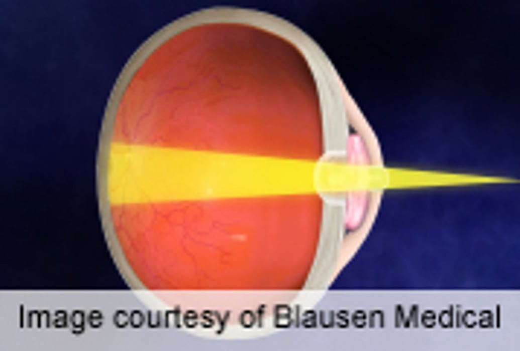Vision Measured in Clinic Better Than That Measured at Home