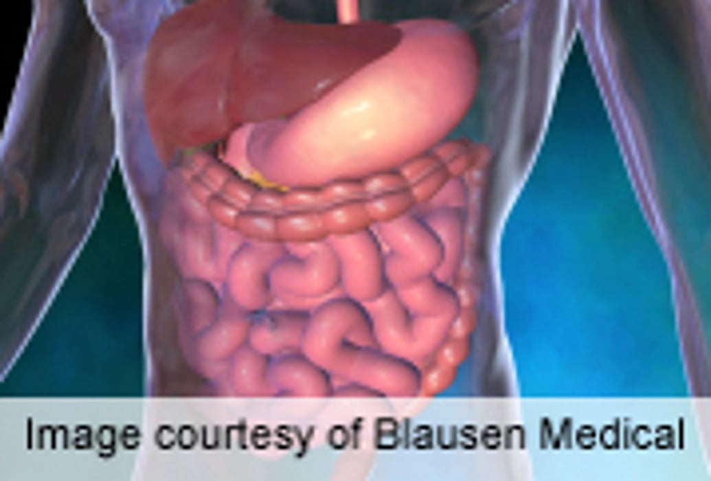Salmonella-Induced Gastroenteritis Ups Risk of IBS