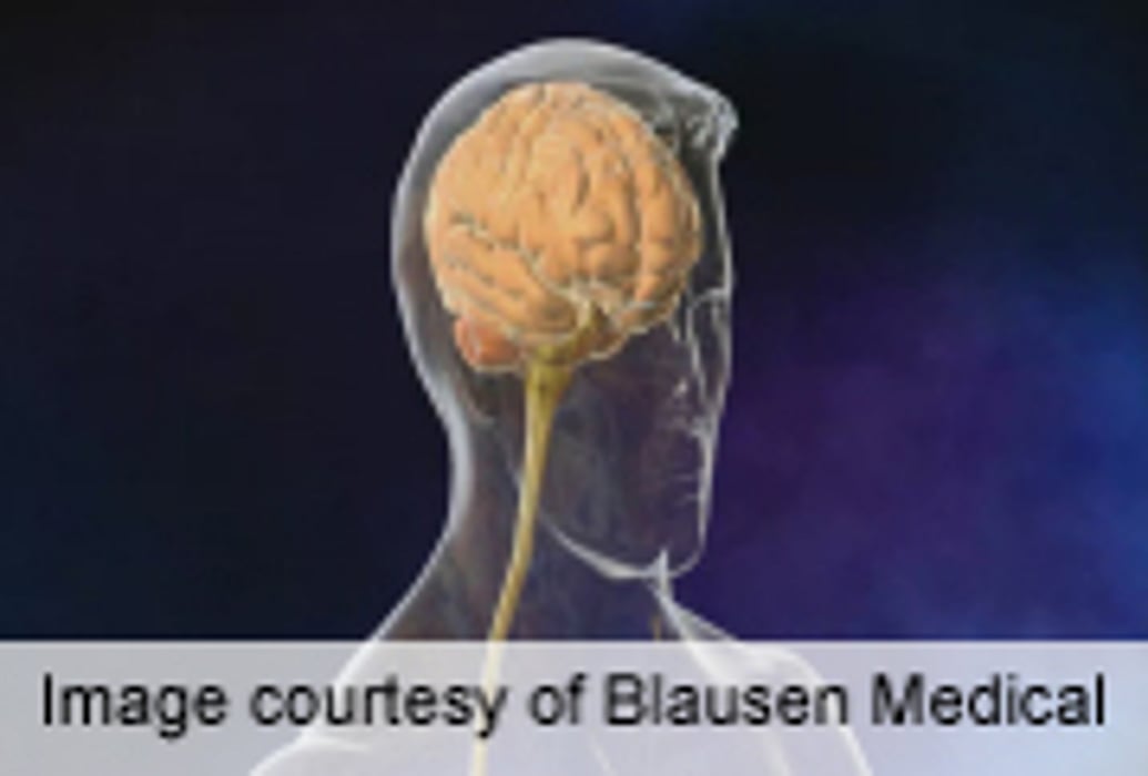 Brain Measurements Predict Age With 92 Percent Accuracy