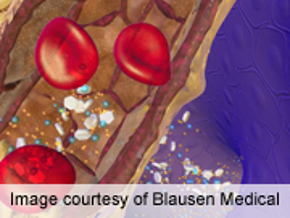 Autoantibodies Predict Severity of IgA Nephropathy