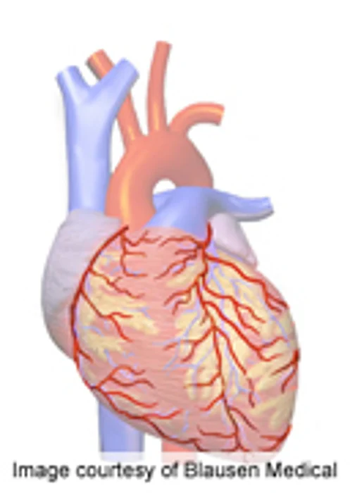 High BPA Levels Seen in People With Narrowed Arteries: Study