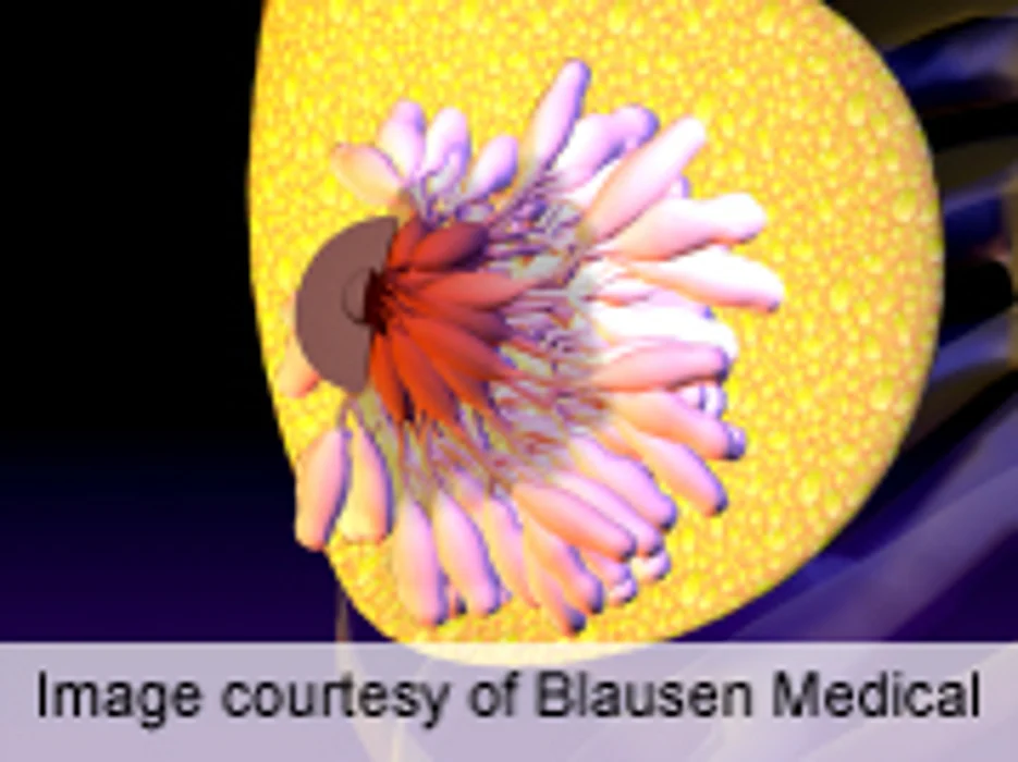 High Density on Mammograms Not Tied to Risk of Death