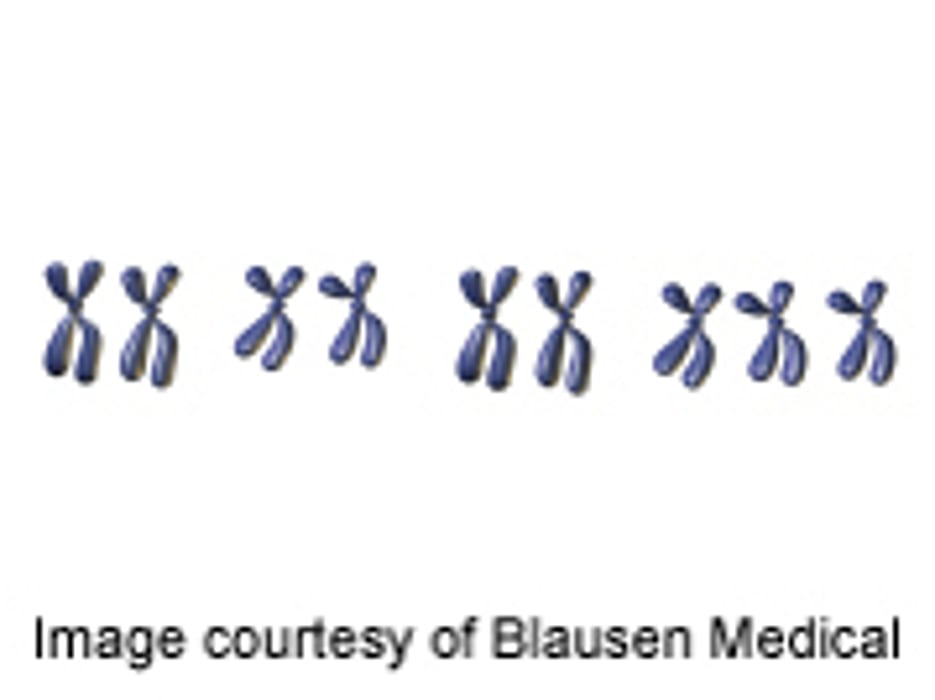 Much of Intellectual Disability Not Genetically Inherited