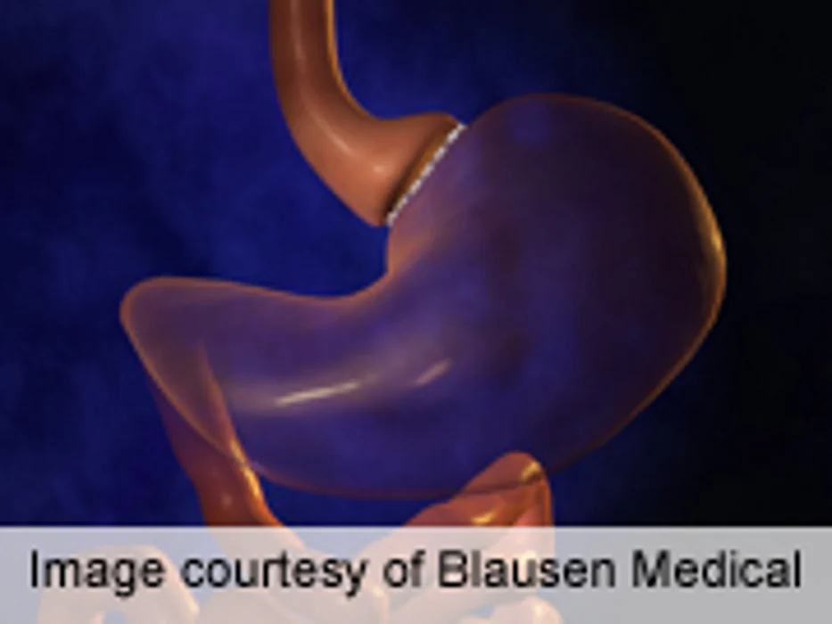 History of Sexual Abuse Slows Response to Bariatric Surgery