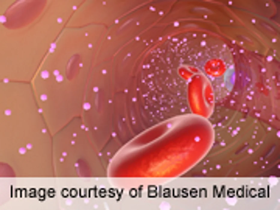 Neonatal Outcomes Unaffected by Transfused Blood Cell Age