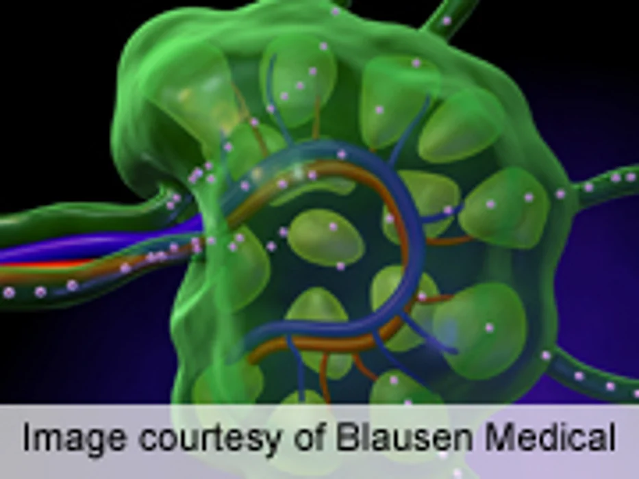 HIV Status Doesn't Influence Hodgkin's Lymphoma Outcome