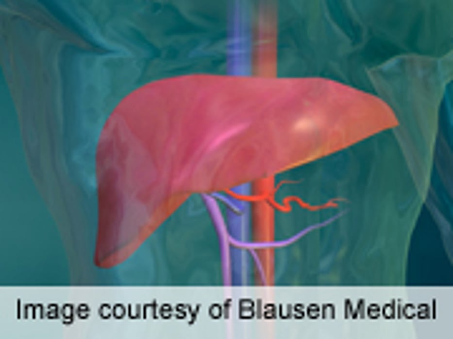 PET-CT Rarely Impacts Surgical Management of CRC Metastases