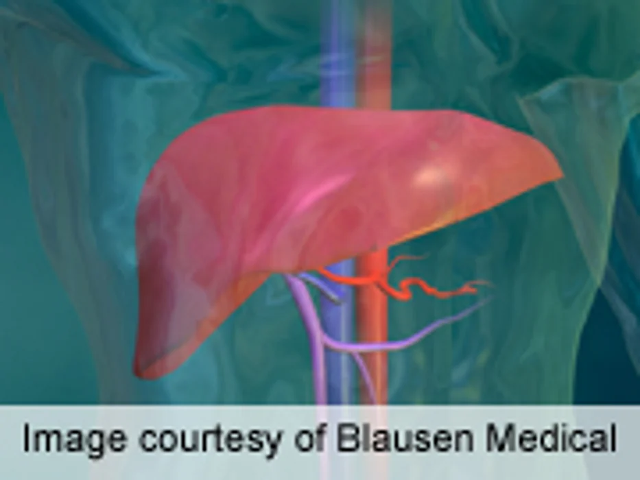 Hypernatremia Linked to Post-Liver Transplant Mortality