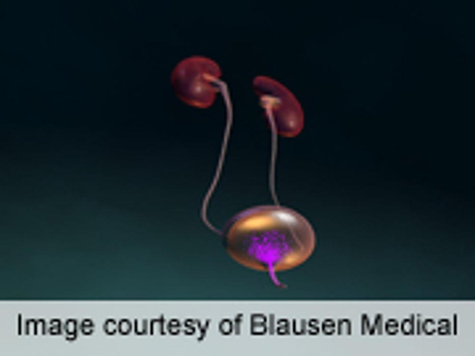 Fluoro-Less Ureteral Stent Placement Deemed Feasible