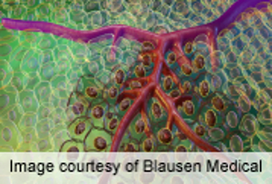Study Suggests How Obesity Promotes Tumor Growth