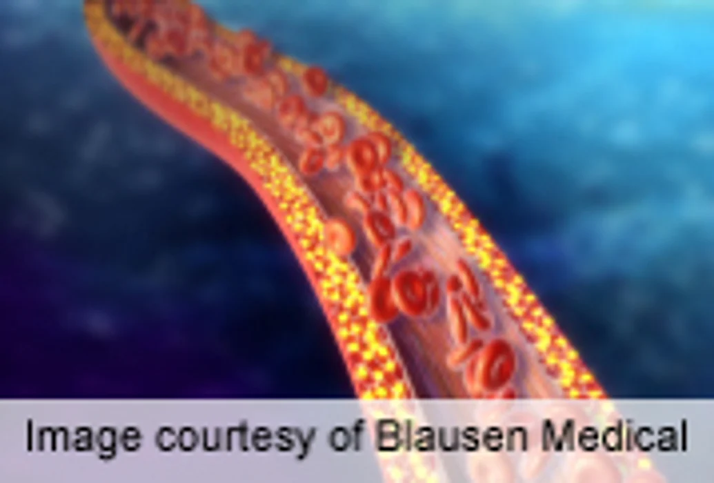 Rituximab Equally Effective for Remission of Vasculitis