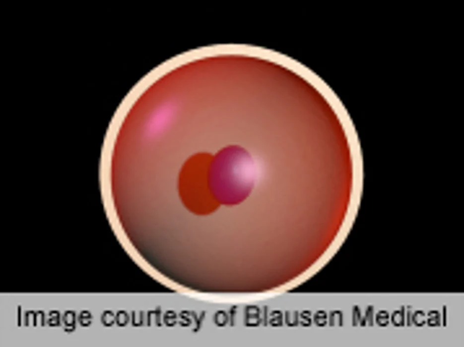 Bisphenol-A Has Detrimental Effects on Oocytes