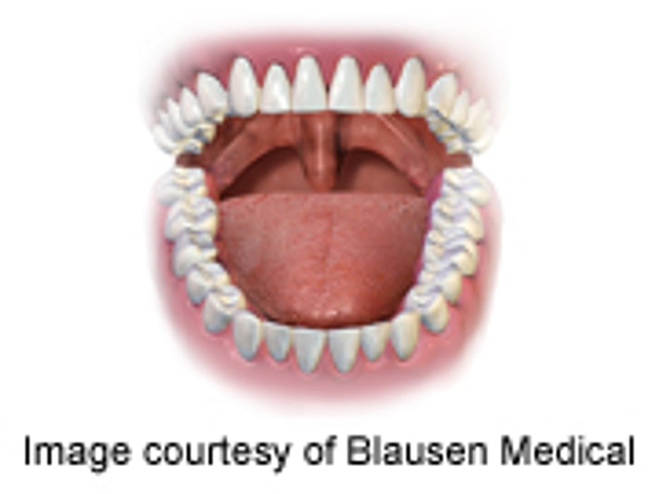 Review: Rapid Antigen Tests Accurate for Strep Diagnosis