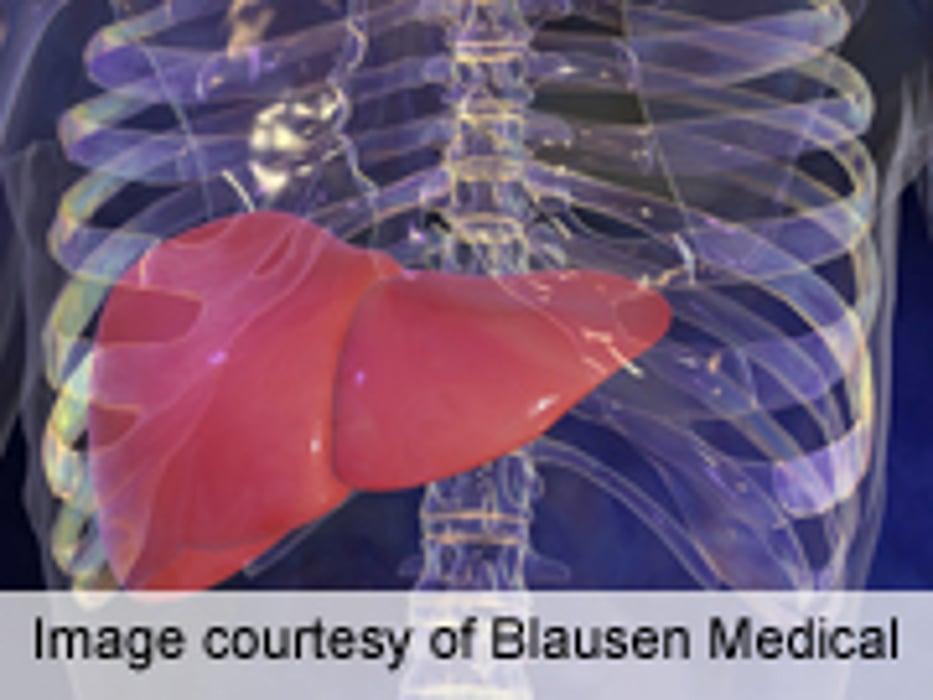 Diabetes With Obesity Ups Liver Transplant Morbidity