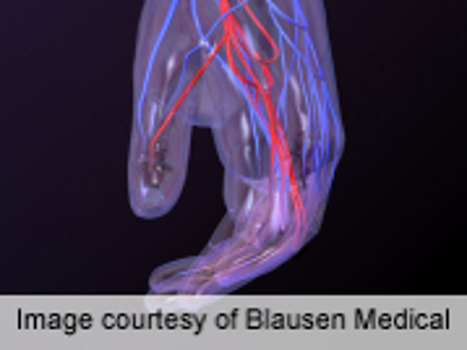 Preparation Process Eases MRI for Children With Sickle Cell