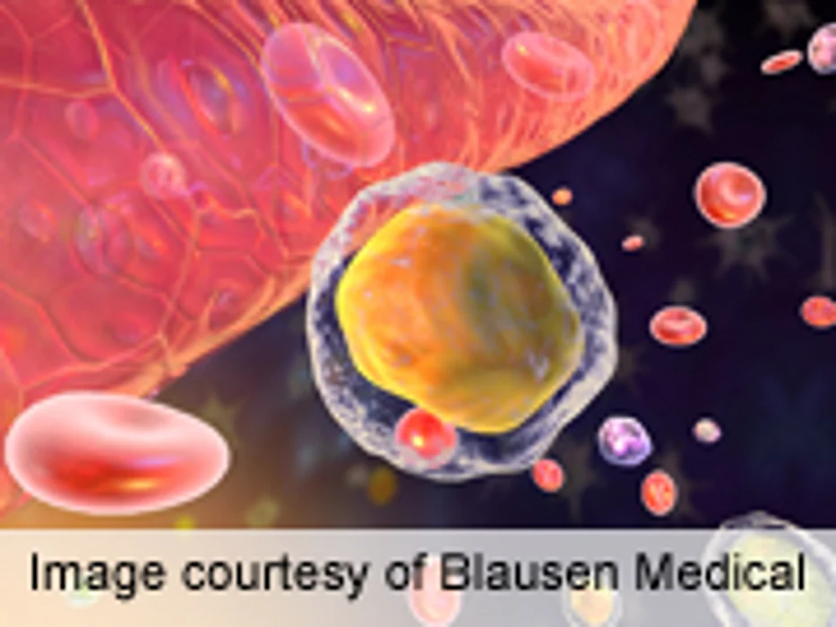 Flow Cytometry Indicates Treatment Response in AML