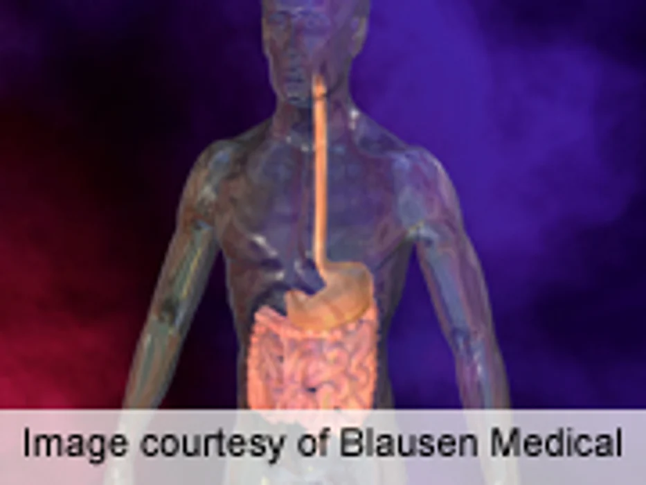 Hormones, Amino Acids Altered by Gastric Bypass Surgery