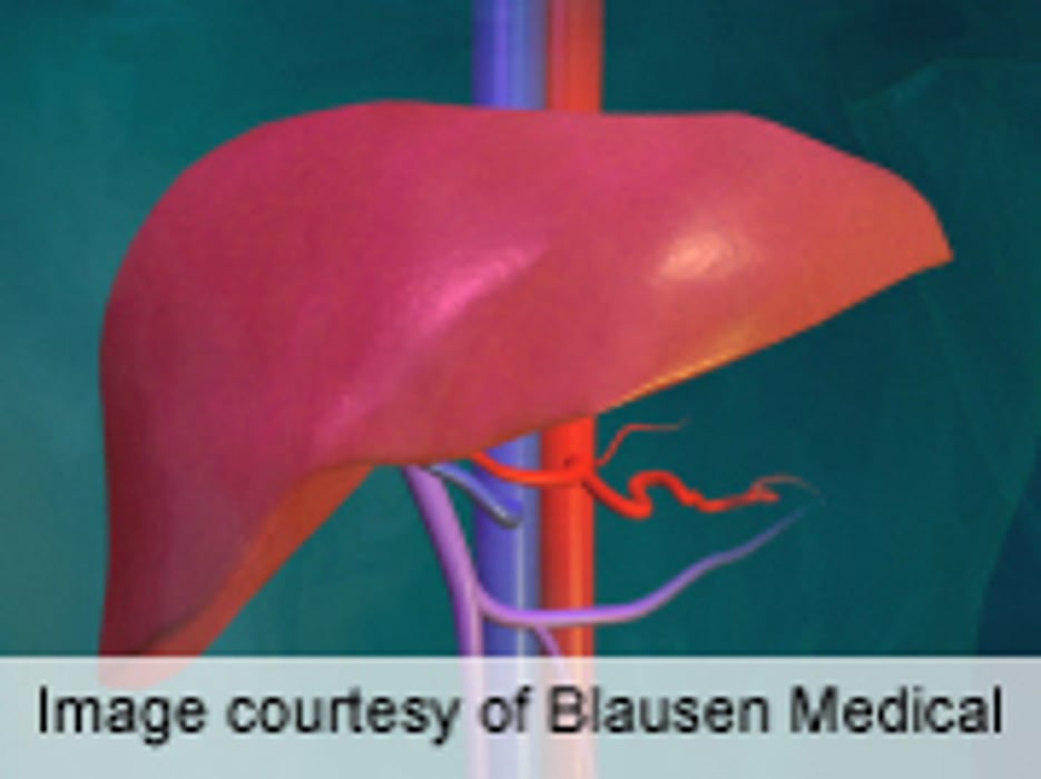 For Living Donor, Liver Transplant Mortality Rate at 0.2 Percent