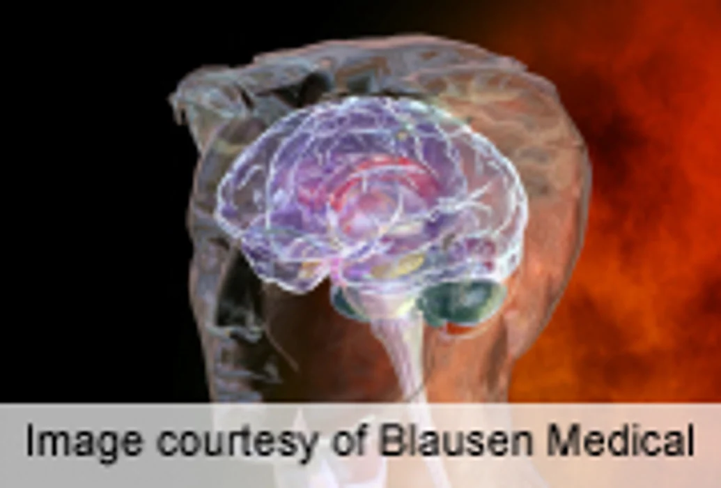 Pregnancy Risks Up for Women With Bipolar Disorder