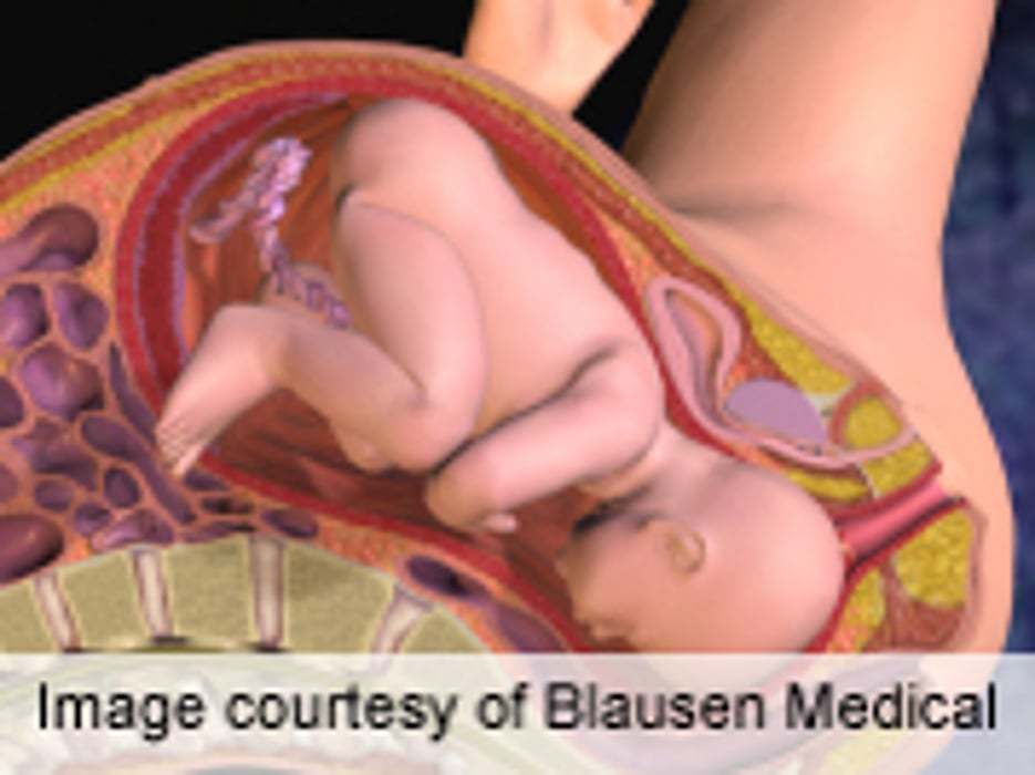 Strategic Alliance Could Reduce Burden of Preterm Birth
