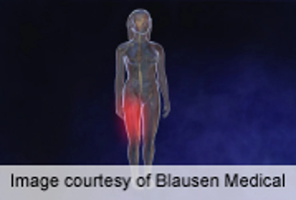 Impaired Central Pain Mechanism for Patients With RA