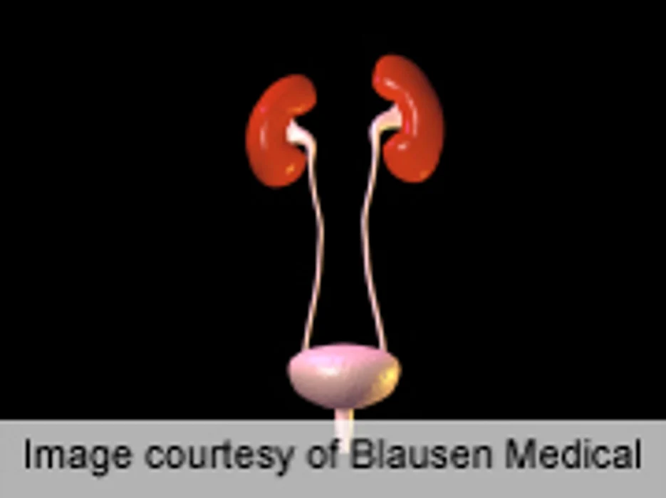Survival Advantage for Whites With Renal Cell Carcinoma