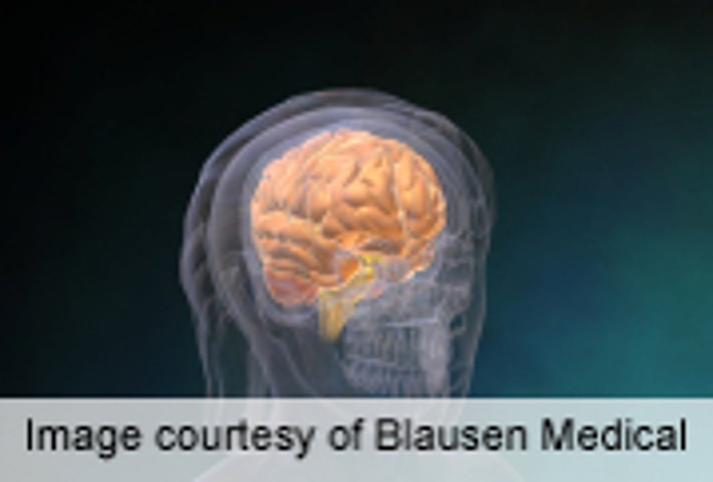 Kids' Concussion Recovery Varies by Symptom Severity: Study