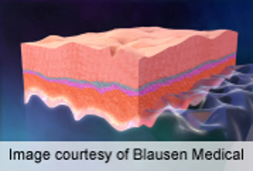 AAD: Skin Changes Can Be First Sign of Underlying Condition