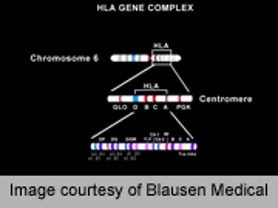 Whole-Genome Sequencing Helps ID MRSA Outbreaks
