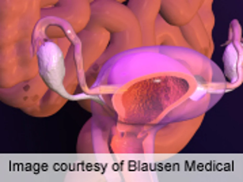 Earlier Menarche Linked to Overall Adiposity
