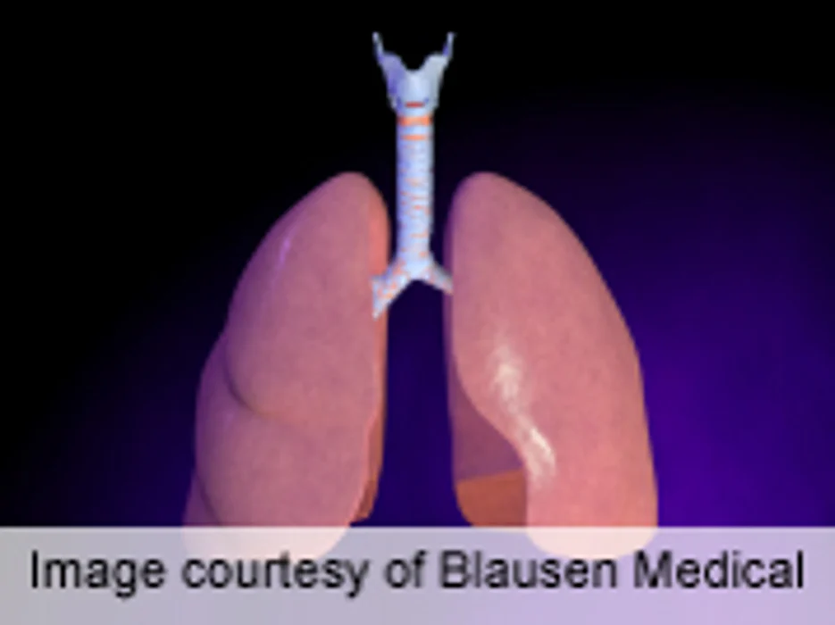 Pulmonary Complications Often Fatal in Systemic JIA