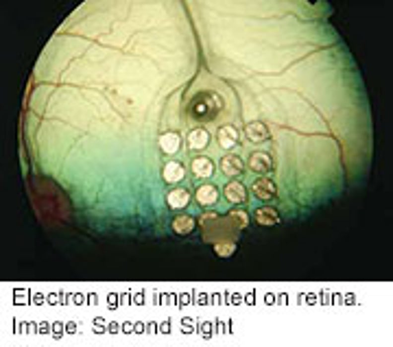 Device May Allow Blind to Read Braille Without Touch: Report
