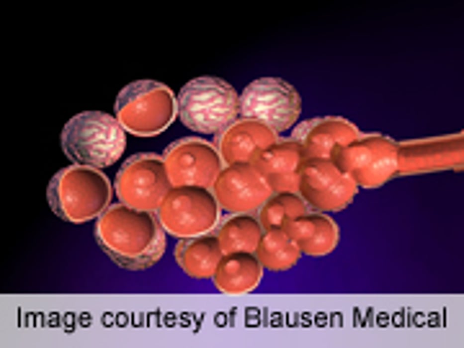 Prevalence of COPD About 6 Percent Across the U.S.