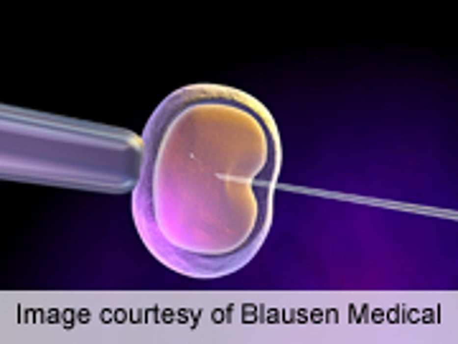 Training Model Protects Embryo Transfer Success Rates