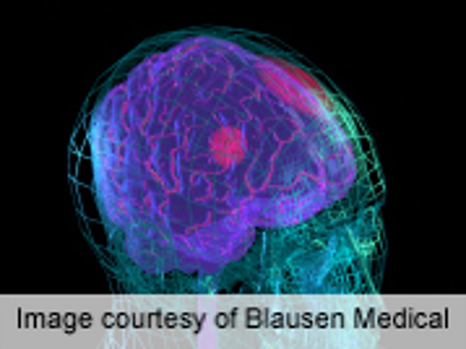 Herpes Zoster Is Risk Factor for Stroke in Young Adults
