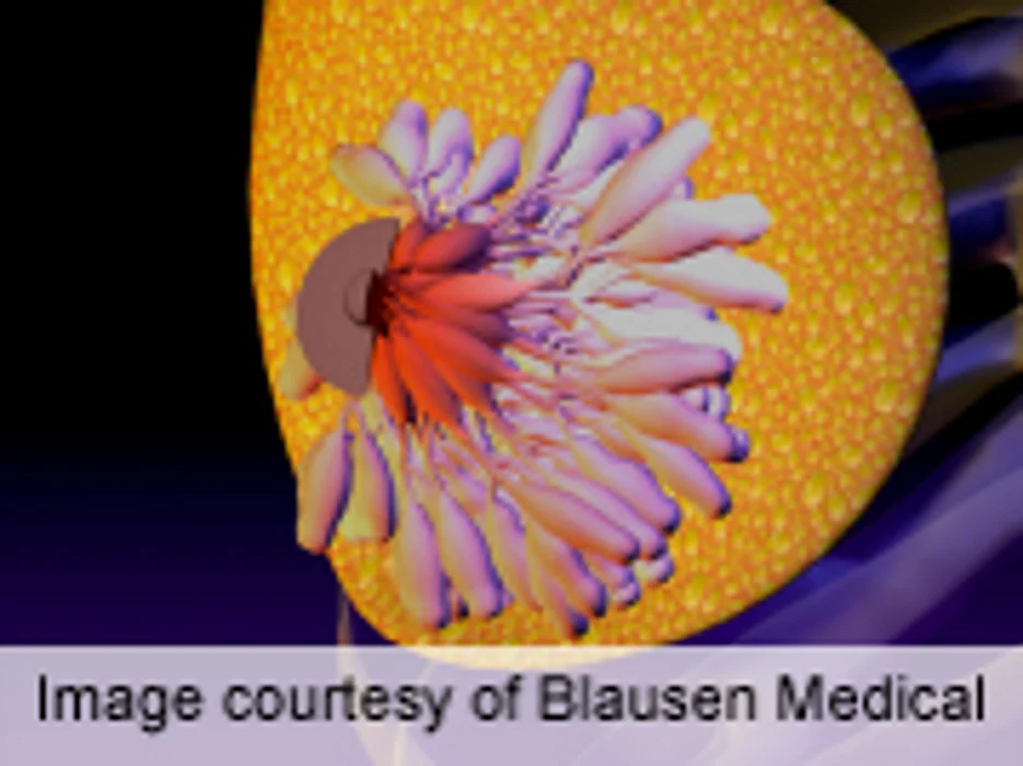 Surgery Not Needed With All Abnormal Breast Lesions