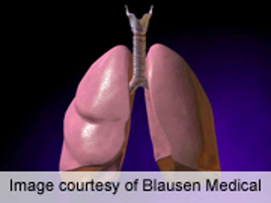Lung Cancer Scares Vary by State, Study Finds