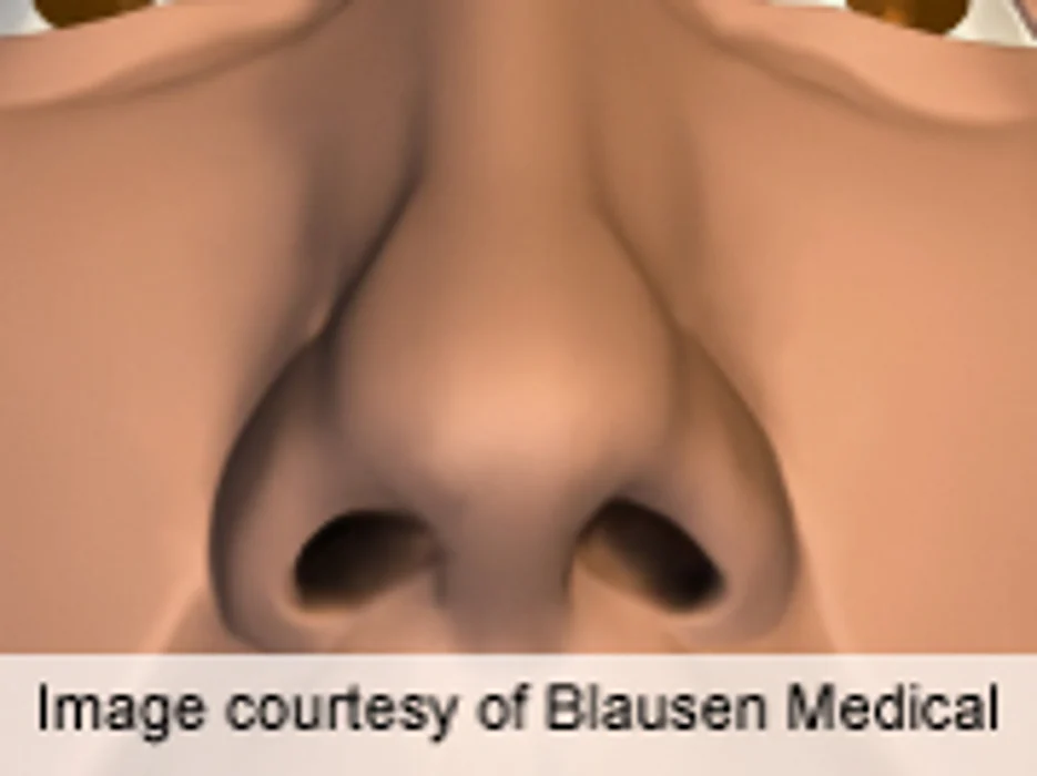 New Surgical Concept Described for Nasal Tip Recontouring