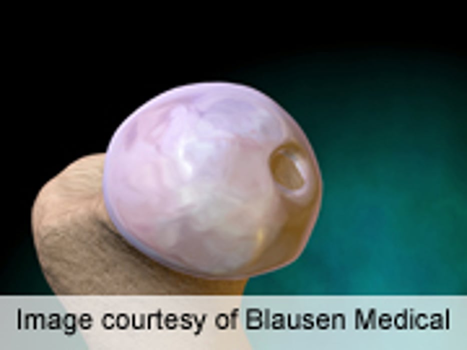 Neuraxial Bests General Anesthesia in Arthroplasty