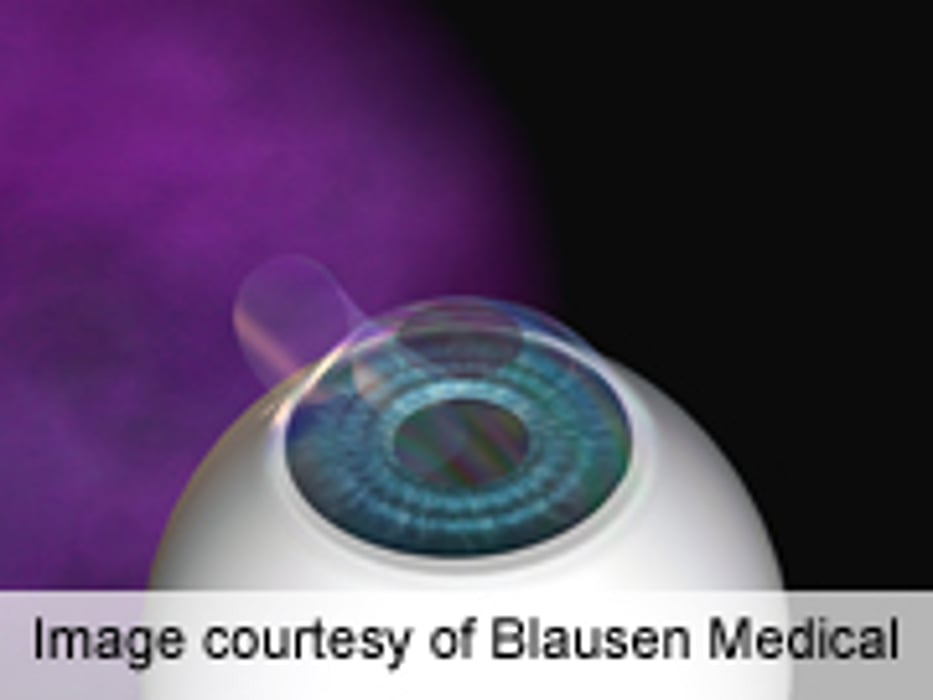 FDA: Some Eye Care Provider Ads Mislead About LASIK Risks