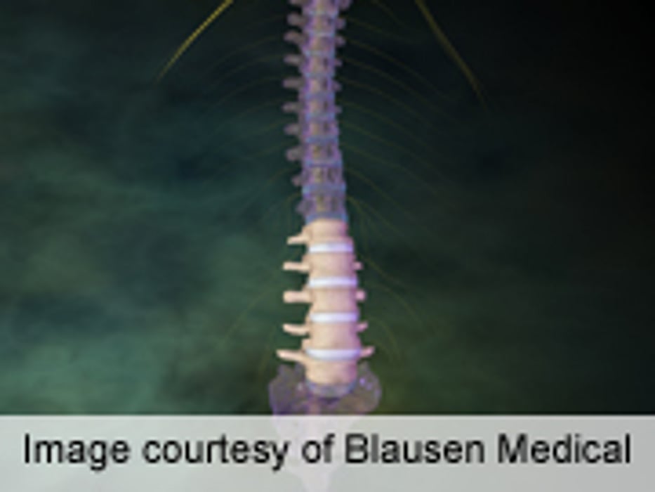 Full, Limited Range of Motion Extension Exercise Benefit LBP