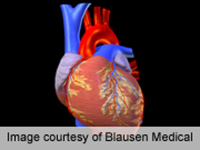 Smoking Impairs Saphenous Vein Conduits in CABG Surgery Consumer