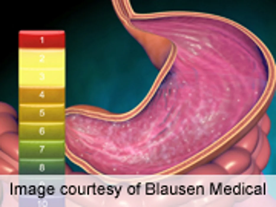 Which Hospital Patients Need Drugs to Prevent Gastrointestinal Bleeding?