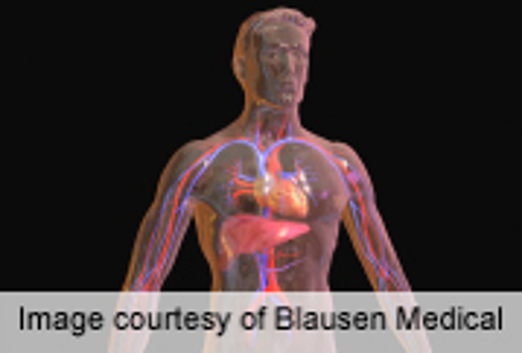 Cardiac Deaths May Lead to Shortage of Donor Livers